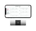 AliveCor KardiaMobile 6L Personal EKG Monitor, Black - KM-6L-E